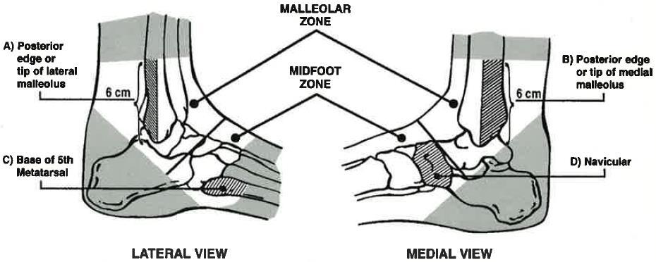 RADIOGRAPHY OF THE ANKLE AND FOOT (OTTAWA ANKLE RULES) Clinical Practice Guideline January 2007 This guideline has been adapted frm the Ottawa Ankle Rules develped by Dr.