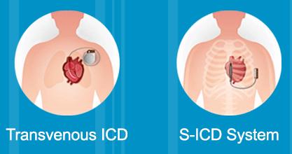 Which ICD System is right for me? Each system has its advantages; each patient has different clinical needs.