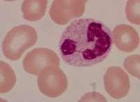 60% of all WBCs Nuclei of 2-6 lobes Other names: Neutrophils Polymorphonuclear cells (PMNs, polys,