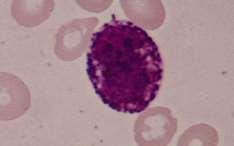 Rarest WBC Bilobed nucleus Dark purple granules Basophils Later stages of