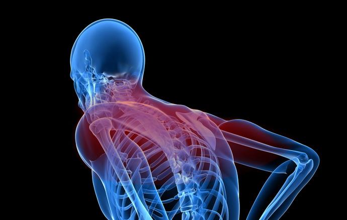 Upper Spine (cervical) problems can cause neck pain that may shoot into the