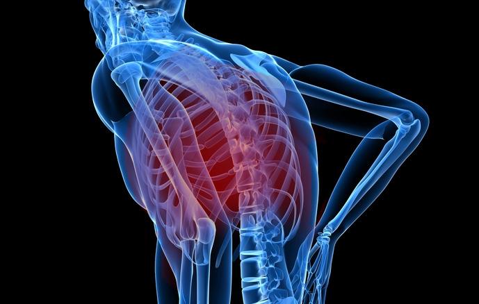 Lower spine (lumbar) problems can cause low back pain that may shoot into your
