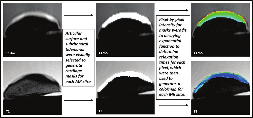 Figure 6: Image analysis method for determining T1rho and T2 relaxation times and generating T1rho and T2 colormaps.