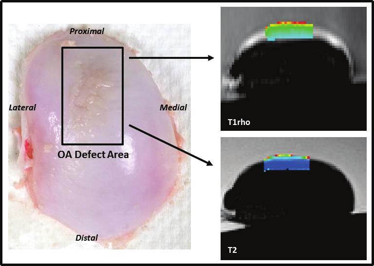 corresponding data. Figure 7: Method for isolating OA affected areas of cartilage.