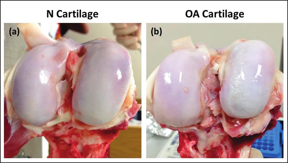 Figure 10: Gross joint photographs for visual grading of cartilage. (a) Normal cartilage and (b) OA cartilage 2.3.