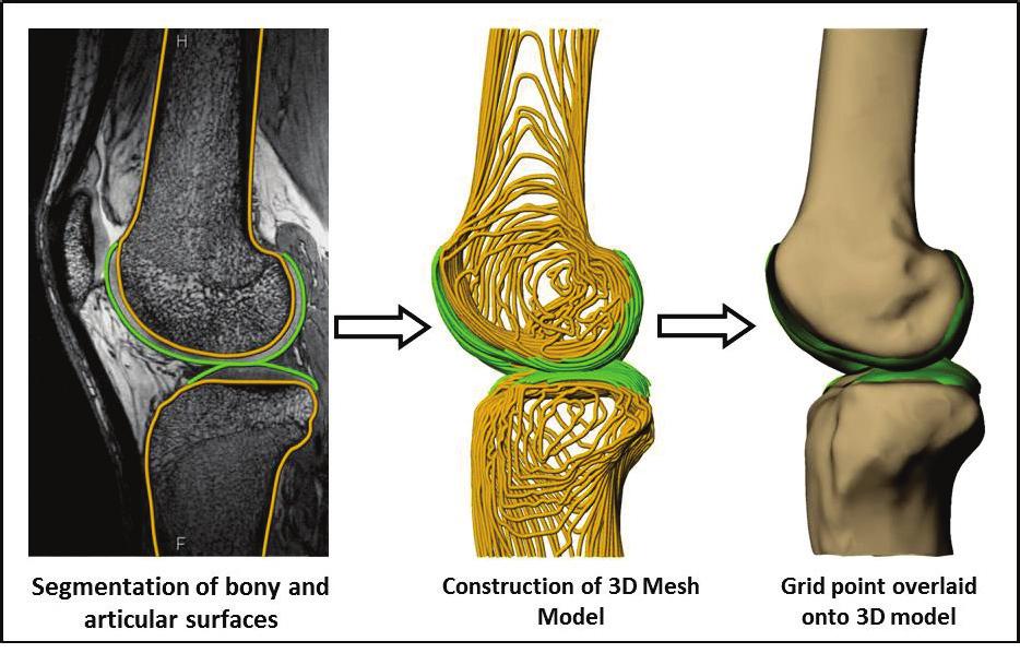 Figure 24: Image segmentation of the bony and articular surfaces to construct a 3D mesh model of