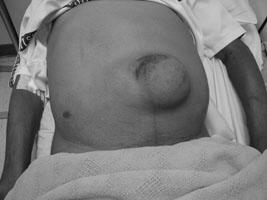 Peritonitis Diagnostic tests Flat plate of the abdomen CBE Medical management/nursing interventions Position