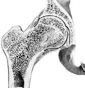 Below the compact bone is the spongy bone, which has holes to keep the bones light in weight so our muscles can lift them.