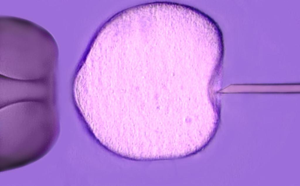 In Vitro Fertilization (IVF) Indications Wide ranging: targeted or
