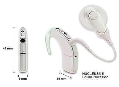and Electrode Array Cochlear Hearing Loss Sensory