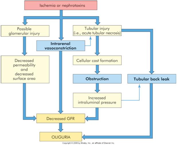 Acute Renal Failure infection Mechanism of oligu