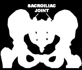 Sacroiliac Joint The joint between the sacrum and the ilium