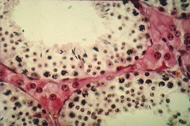 Sertoli cell Leydig cell Seminiferous