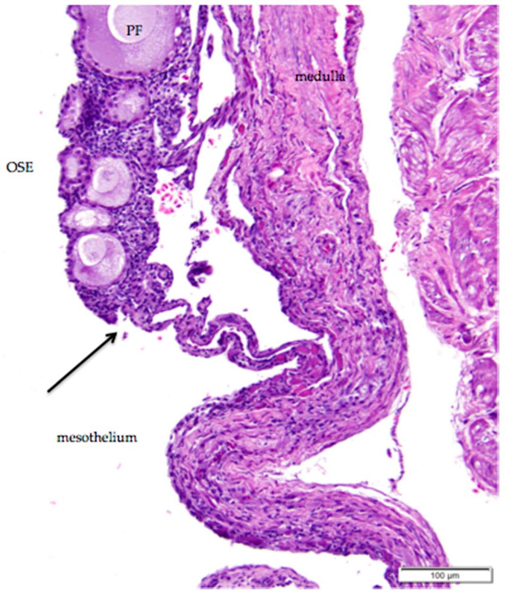 The simple cuboidal ovarian surface epithelium (OSE)