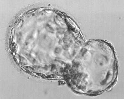 Early blastocyst