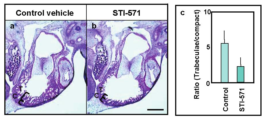 Figure S5 Abl kinase regulates the trabecular formation in developing cardiac ventricle. As shown in Fig.