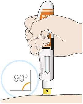 If somebody else gives you the injection, you can also use the outer area of the upper arm. Change the injection site each time you inject.