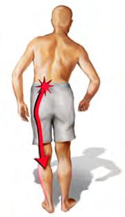 Clinical diagnosis of LSS Pain in the low back