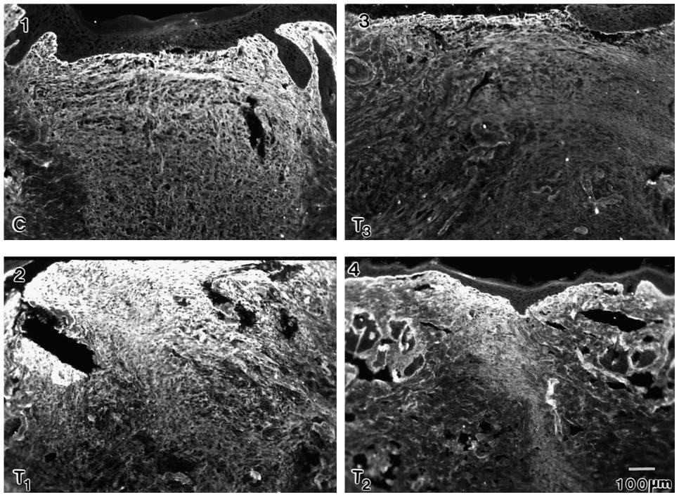998 M. Shah, D. M. Foreman and M. W. J. Ferguson Fig. 12. Isoform specific effects of TGF-β on collagen III deposition in healing wounds.