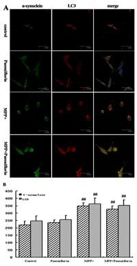 Flash Posters 607 Figure3 Conclusion: In this study, we demonstrated that PF upregulated both autophagy and ubiquitin proteasome pathways significantly, promoting the degradation of α-synuclein and