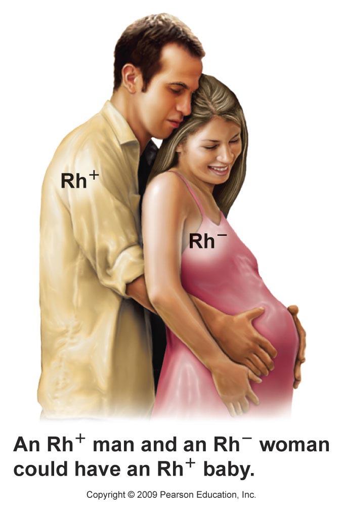 Blood Types Rh Factor Rh-negative person