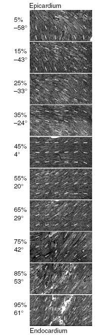 From fibers to muscle Fiber architecture and