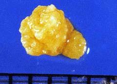 Miniature Schnauzer, Miniature Poodle, Bichon Frise, and Cocker Spaniel are the most affected breeds. Urinary tract infection is an important factor in the formation of struvite stones.