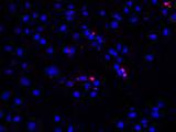SARS-CoV-infected SARS-CoV NP 5 µm Apoptotic cells (%) DOI: 1.