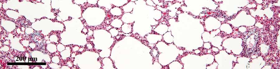 23. Group Iso2 Lung (Goldner s trichrome stain)
