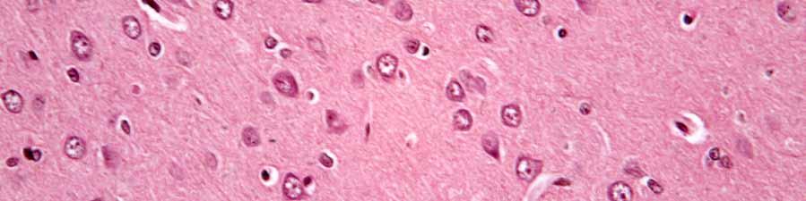 Group SevoM Brain (Goldner s trichrome stain) In the
