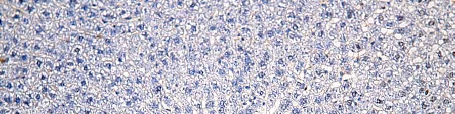 hepatocyte apoptosis. Fig. 6.