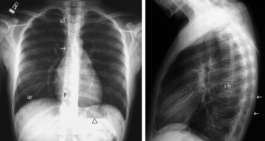 3 Chest Exmintions in Children The chest film is the most frequently ordered peditric rdiogrphic exmintion.