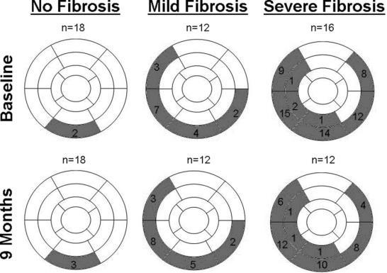 myocardial fibrosis and the clinical