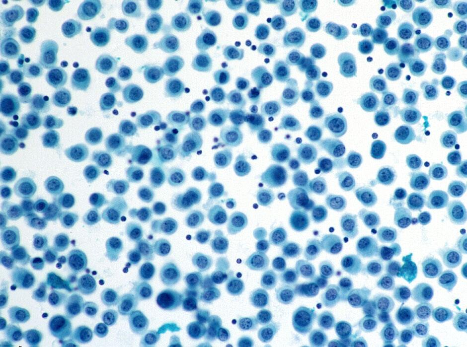 Pattern 4: Single Cell