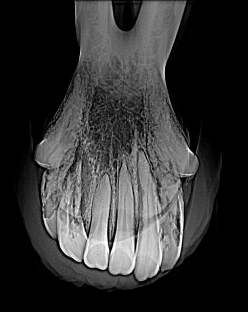 Figure 4. Ventrodorsal radiographic projection of the rostral aspect of the mandible of a 23-year-old horse.