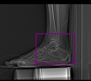 P a g e 3 Ankle Ankle Arthrogram: Scan range to include