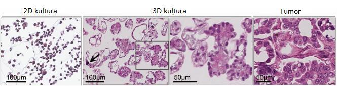 Slika 3. Stanična linija karcinoma jajnika OAW42 u 2D i 3D kulturi. 3D kultura pokazuje stanice nalik onima karcinoma jajnika in vivo, prikazan desno.