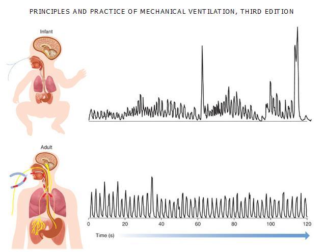 Effect of age Sinderby & Beck, Neurally Adjusted Ventilatory Assist in Principles and