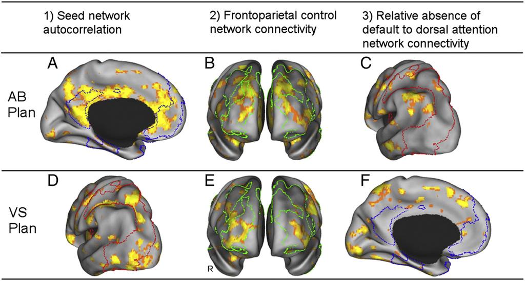 314 R.N. Spreng et al. / NeuroImage 53 (2010) 303 317 Fig. 8. Task-related functional connectivity analysis.