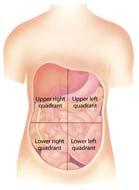 irritation Peritoneal inflammation Bleeding Obstruction Peptic ulcer disease Gastritis Pneumonia