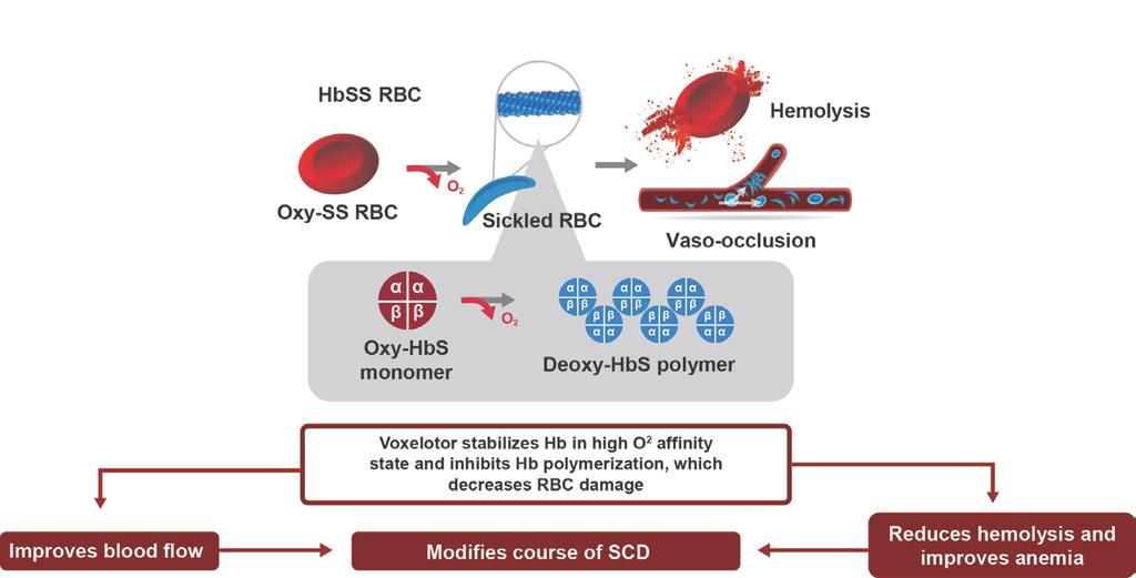 Voxelotor Clinical Hypothesis: Upstream Interruption of HbS Polymerization With Potential to Modify Disease Voxelotor first-in-class, oral, once-daily therapy that modulates the affinity of
