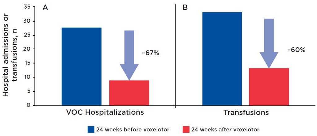 Clinical and Laboratory Efficacy (cont d) Large Reductions in VOC Hospitalizations and RBC Transfusions In the 24 weeks before and after voxelotor treatment Total hospitalizations for VOC pain
