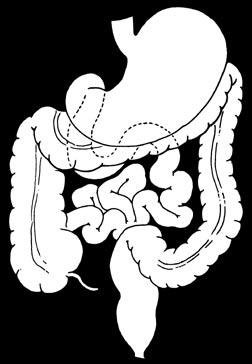 Large intestine or