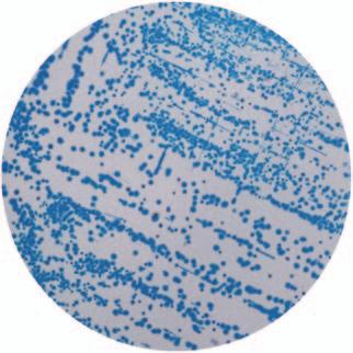 Listeria monocytogenes: Blue with a positive halo Enterococcus faecalis: Inhibited Listeria innocua: Blue with a negative halo : Inhibited Listeria monocytogenes Lipase C - Lipase C Listeria innocua