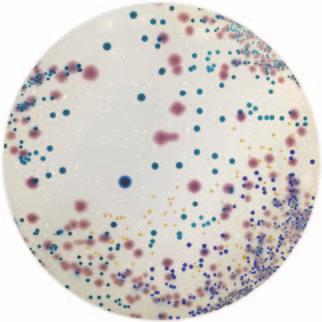 MRSA Agar For the presumptive detection of Methicillin resistant aureus in clinical samples. α-glucosidase produced by aureus cleaves the chromogenic and gives a blue color to aureus colonies.