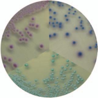 Different colored colonies allow easy plate reading. Must also be observed at 48 and 72 hours. Different pack sizes: 505 g/100 g/bulk packs/90 mm plates.
