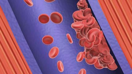 Platelets NOTE: Haemophiliacs are unable to clot