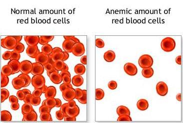 Role of red blood cells: Transport oxygen Haemoglobin is based on molecules of iron