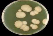 Severally colonies with visually distinguishable morphologies were randomly selected and isolated by directly streaking on Nutrient agar plates and incubated for another 24 hours.