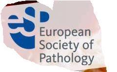 21 European pathologists 1st round - H&E slide set of 15 + 55 serrated polyps 2nd round All 70 cases Criteria list A European Multicenter Study on Serrated Polyps Diagnostic categories Concensus